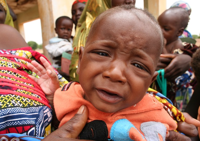 Child at an out-patients therapeutic feeding centre for severely malnourished children in Katsina, Nigeria. Obinna Anyadike/IRIN)